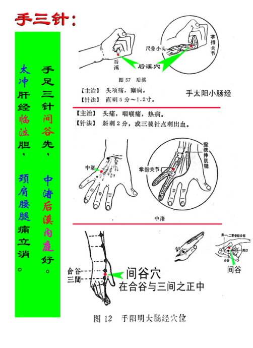 运用手三针,足三针治疗疑难痛症